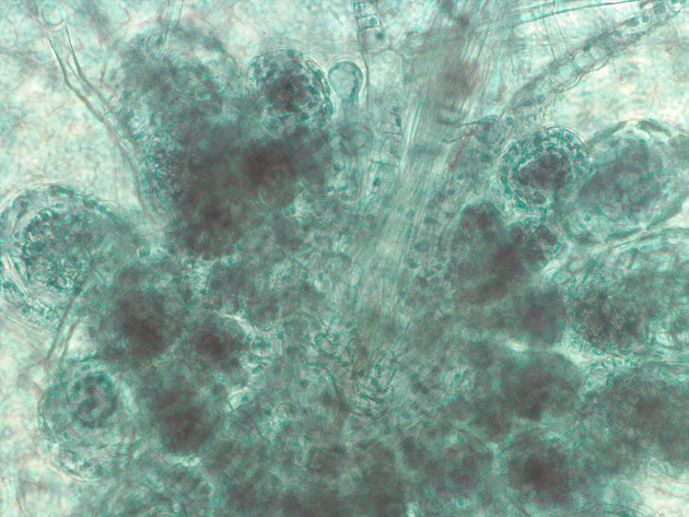 Fern Sori Slides - Fern Sori 03 200X